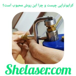 کرایوتراپی چیست و چرا این روش محبوب است؟