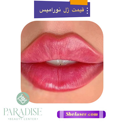 قیمت ژل نورامیس