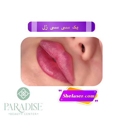 یک سی‌سی ژل 