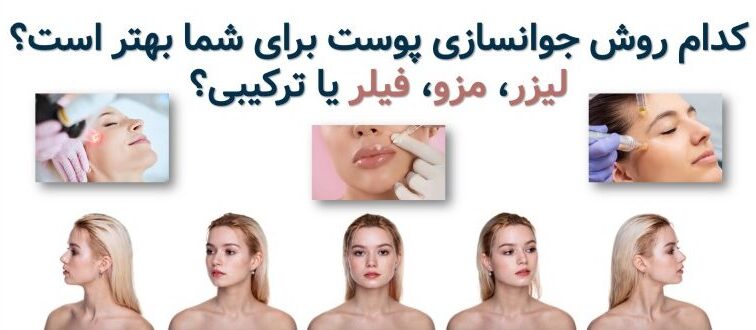 کدام روش جوانسازی بهتر است؟