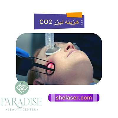 هزینه لیزر CO2