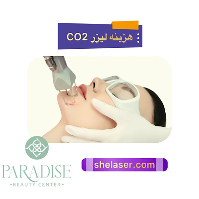 هزینه لیزر CO2