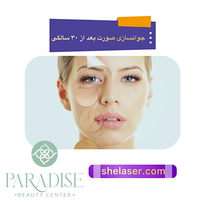 جوانسازی صورت بعد از ۳۰ سالگی