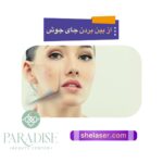 از بین بردن جای جوش