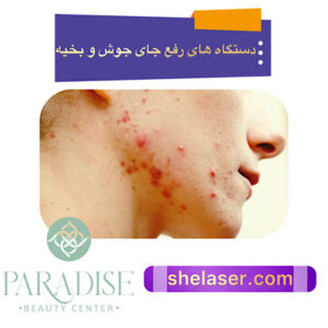 دستگاه های رفع جای جوش و بخیه