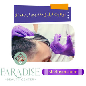 مراقبت قبل و بعد پی آر پی مو