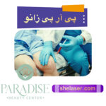 پی‌آر‌پی زانو