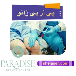 پیآرپی زانو