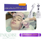 آر اف یا CO2 برای جای جوش