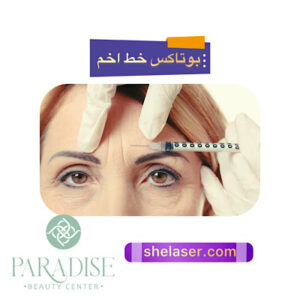 بوتاکس خط اخم