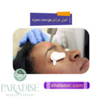 لیزر برای پوست سبزه 