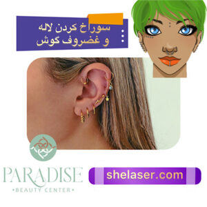 سوراخ کردن لاله و غضروف گوش