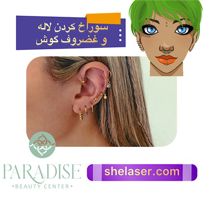 سوراخ کردن لاله و غضروف گوش