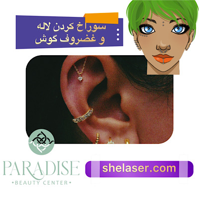 سوراخ کردن لاله و غضروف گوش 