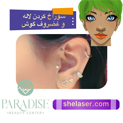 سوراخ کردن لاله و غضروف گوش 
