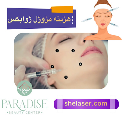 هزینه و قیمت مزوژل ژوابکس