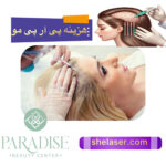 هزینه و قیمت پی آر پی مو