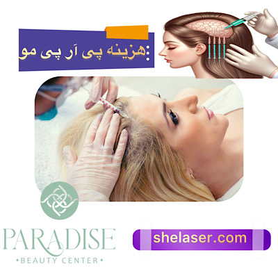 هزینه و قیمت پی آر پی مو