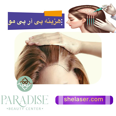 هزینه و قیمت پی آر پی مو