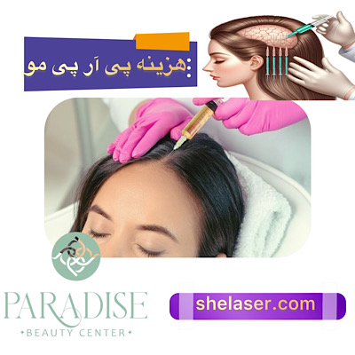 هزینه و قیمت پی آر پی مو