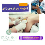 هزینه پی ار پی زانو