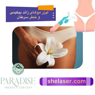 ایا لیزر موهای زائد بیکینی سرطان زا است