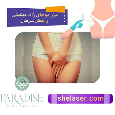 ایا لیزر موهای زائد بیکینی سرطان زا است