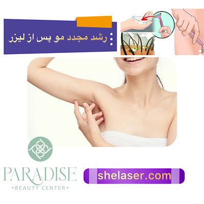 رشد مجدد مو پس از لیزر