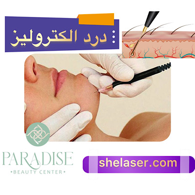 درد الکترولیز