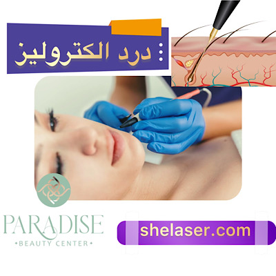 درد الکترولیز