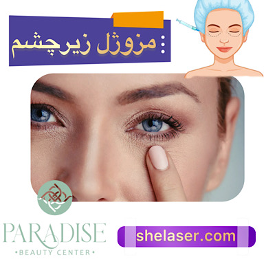 مزوژل زیر چشم