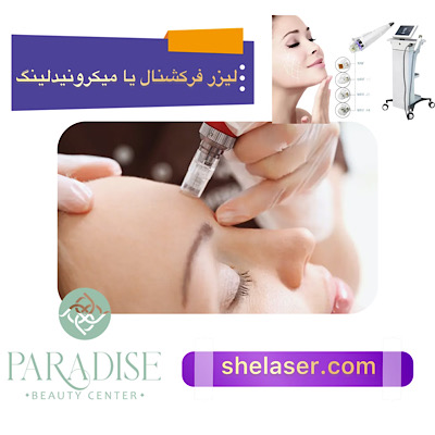 لیزر فرکشنال یا میکرونیدلینگ