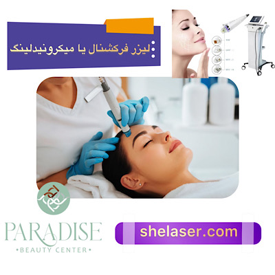 لیزر فرکشنال یا میکرونیدلینگ