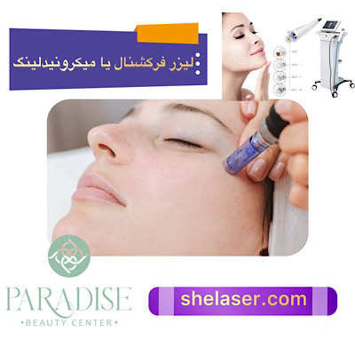 لیزر فرکشنال یا میکرونیدلینگ