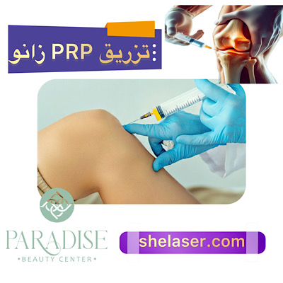 تزریق PRP زانو