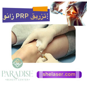 تزریق PRP زانو