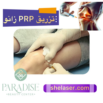 تزریق PRP زانو