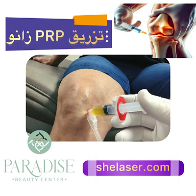 تزریق PRP زانو