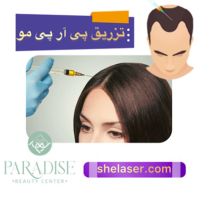 تزریق PRP مو