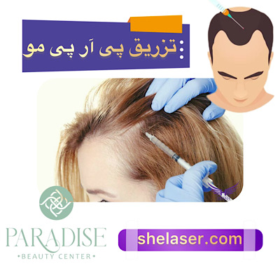 تزریق PRP مو