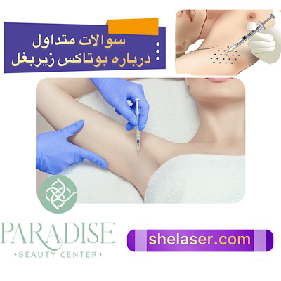 سوالات متداول درباره بوتاکس زیر بغل