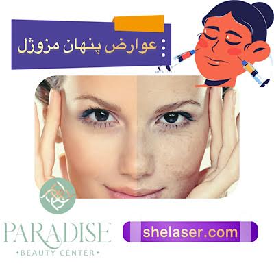 عوارض پنهان مزوژل