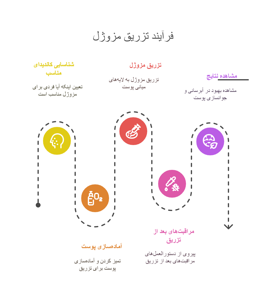 اینفوگرافی مزوژل