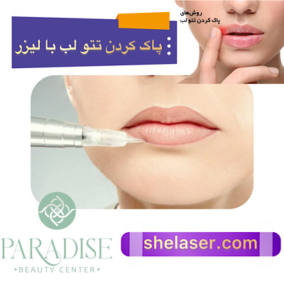 پاک کردن تاتو لب با لیزر