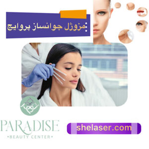 مزوژل جوانساز پروایج