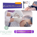 بهترین دستگاه برای پاک کردن تاتو با لیزر