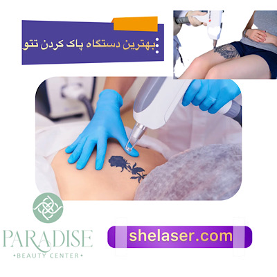 بهترین دستگاه برای پاک کردن تاتو با لیزر