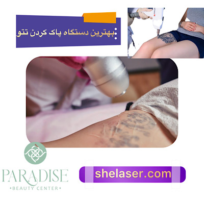 بهترین دستگاه برای پاک کردن تاتو با لیزر