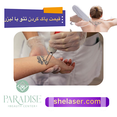 قیمت پاک کردن تتو با لیزر