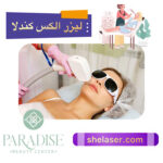 لیزر الکس کندلا